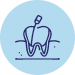 Root canals, wisdom teeth removal, and extractions